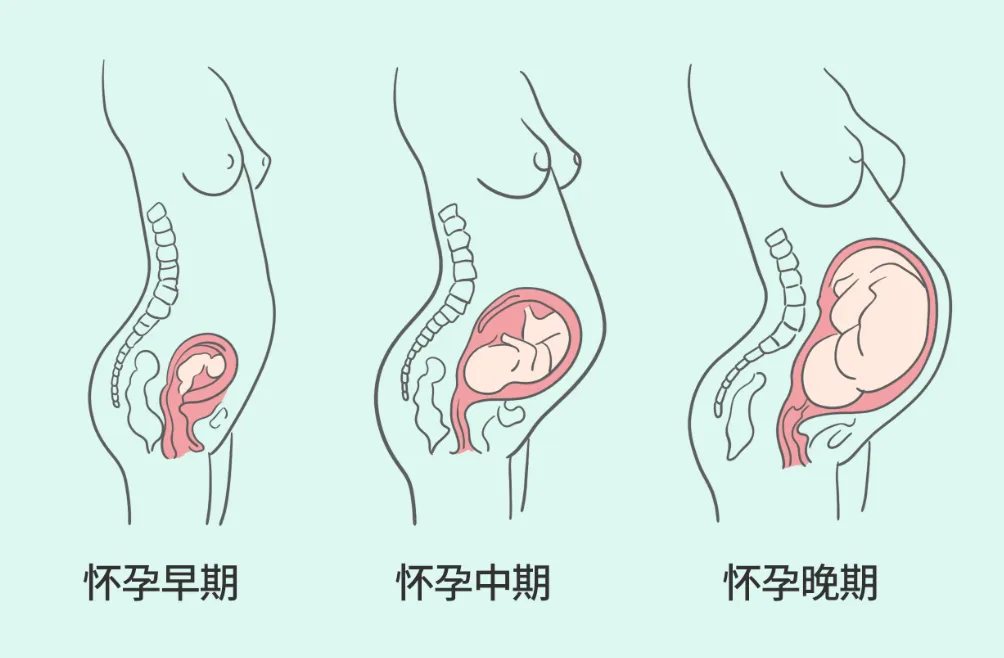 盆底修复2.png